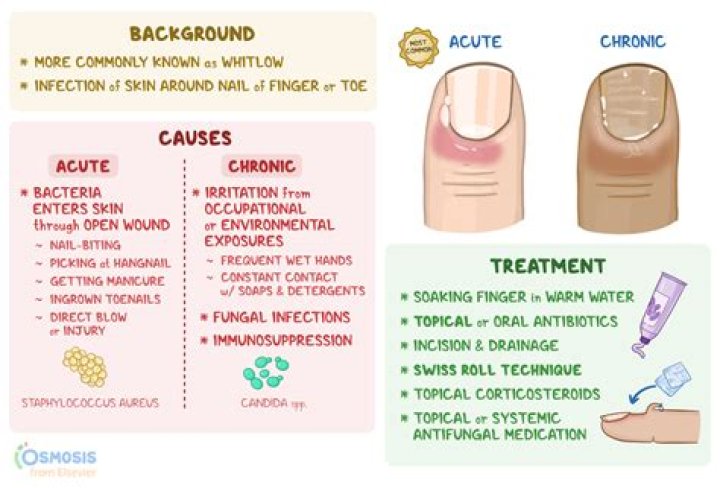 Can a felon be a Paramedic?