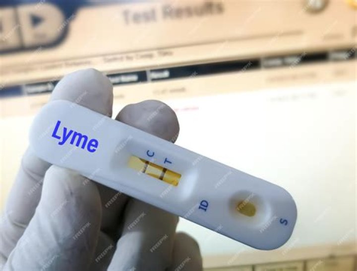 Does insurance cover Lyme disease testing?