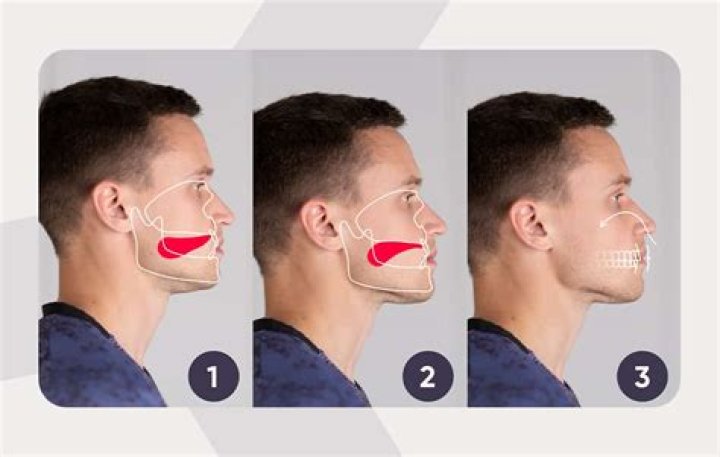 How can I get rid of IRS penalties and interest?