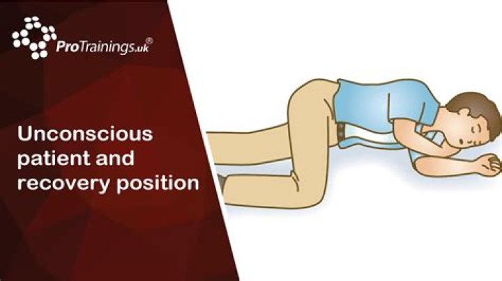 How long does a person stay unconscious after being knocked out?