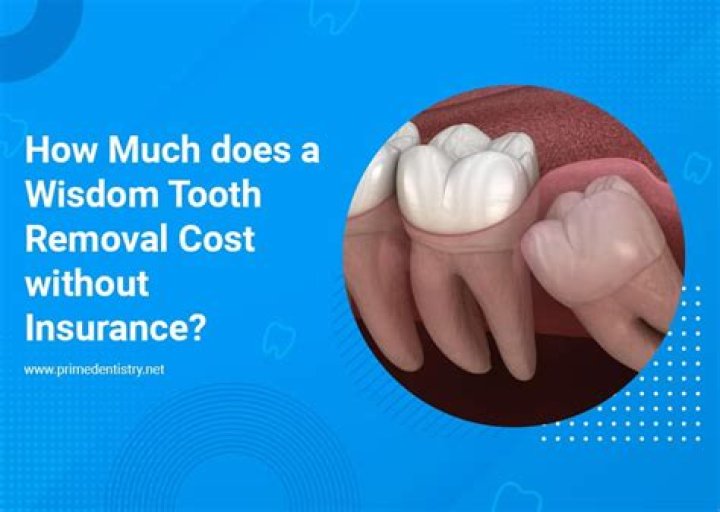 How much does it cost to cap a tooth without insurance?