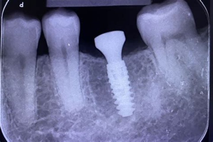 Is GM listed on TSX?