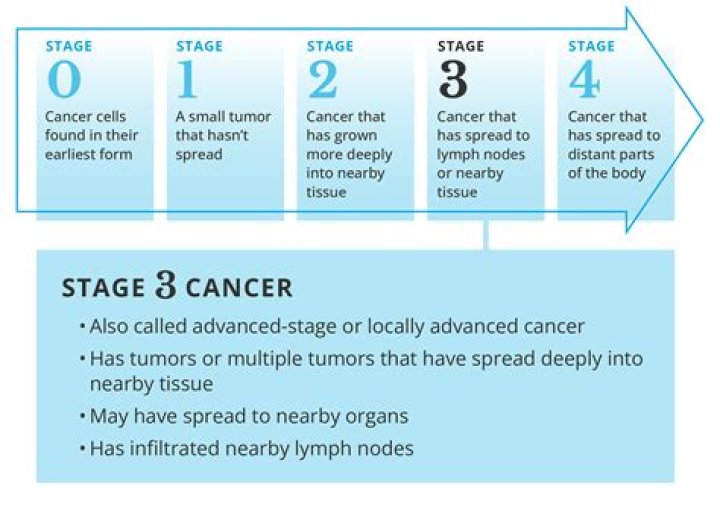 Is Stage 3 prostate cancer a death sentence?