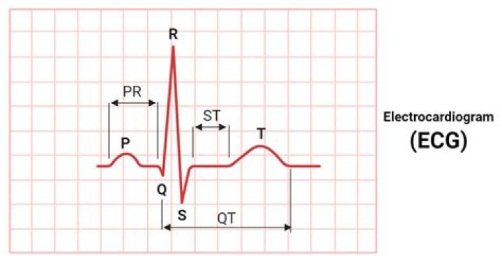 What can an electrocardiogram diagnose?