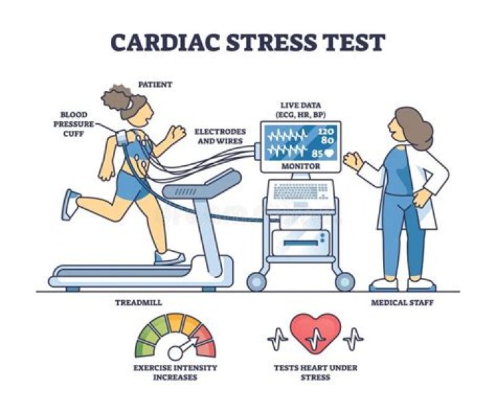 What does a cardiovascular stress test consist of?