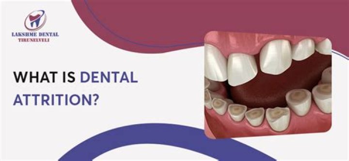 What does attrition rate tell you?