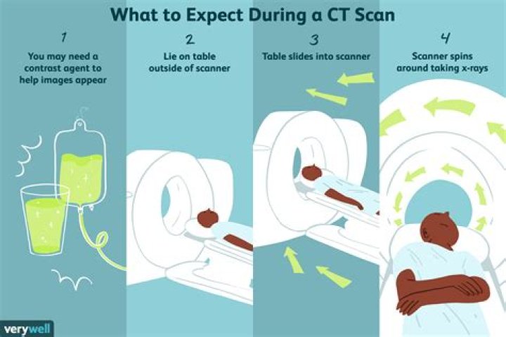 What is a CT 61?