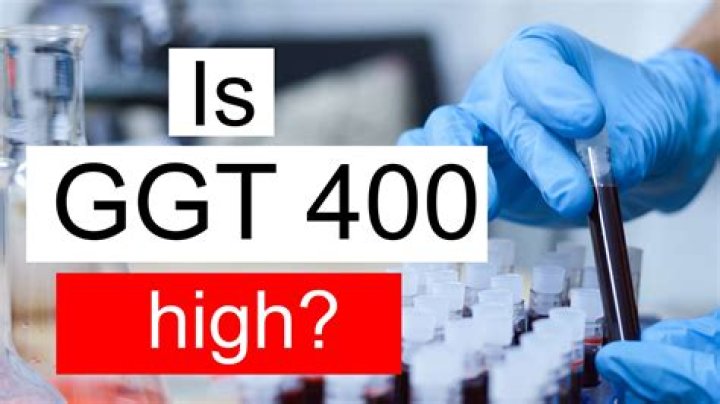 What is considered extremely high GGT?
