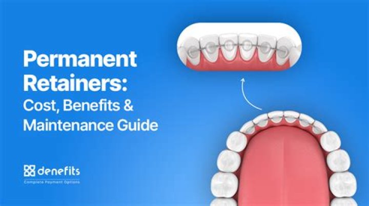 What is the average retainer for a consultant?